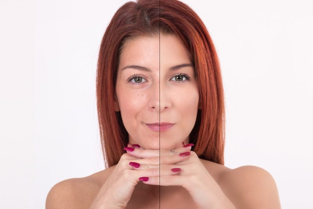 Harmonização Facial: Guia Completo e Definitivo