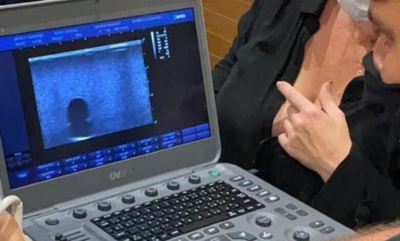Dr Fabio Barros indica como prevenir intercorrências na HOF - Harmonização Orofacial
