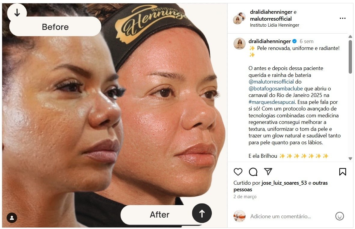 Harmonização Facial: Quem São os Melhores Profissionais do Ano?