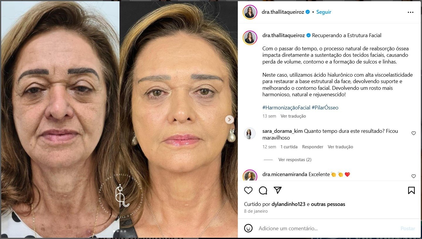 Harmonização Facial: Quem São os Melhores Profissionais do Ano?