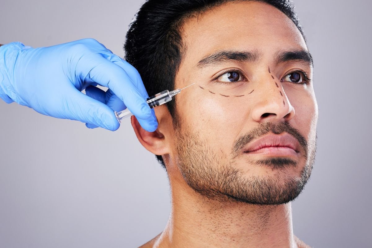 Preenchimento Facial: O Que é e Como Funciona