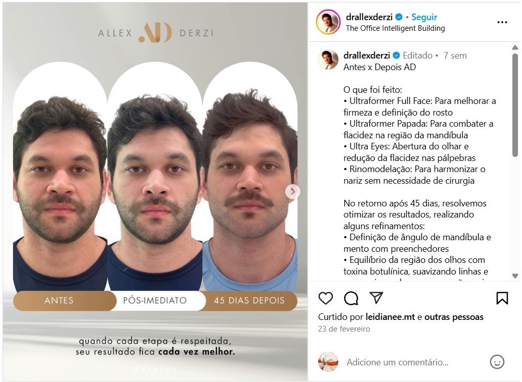 CRO 3788 - Cirurgião Dentista - @drallexderzi